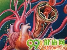 慢性炎症的一组疾病约半数男性在一生中