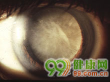 其主要功能是构成后尿道和分泌前列腺液