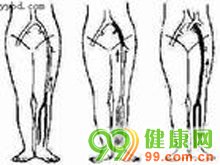 流行性感冒肌炎等