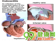约占90%